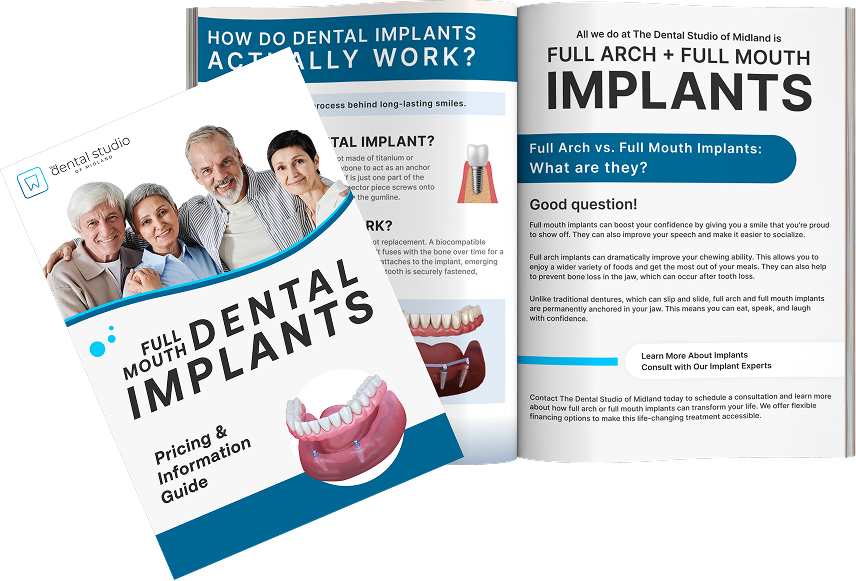 Implant Guideline Image